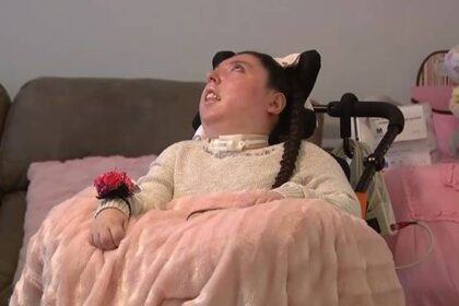 Nascida sem cérebro, jovem celebra 20 anos de vida Nasceu sem cérebro, desafiou a medicina e acaba de celebrar 20 anos: "É uma lutadora"