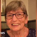 Descobrimento de câncer de pele após campanha da BBC Radio Derby 'I found out I had skin cancer after BBC Radio Derby campaign'